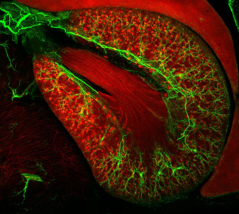 Microscopy image of a mouse organ in red with green web-like structures on a black background.